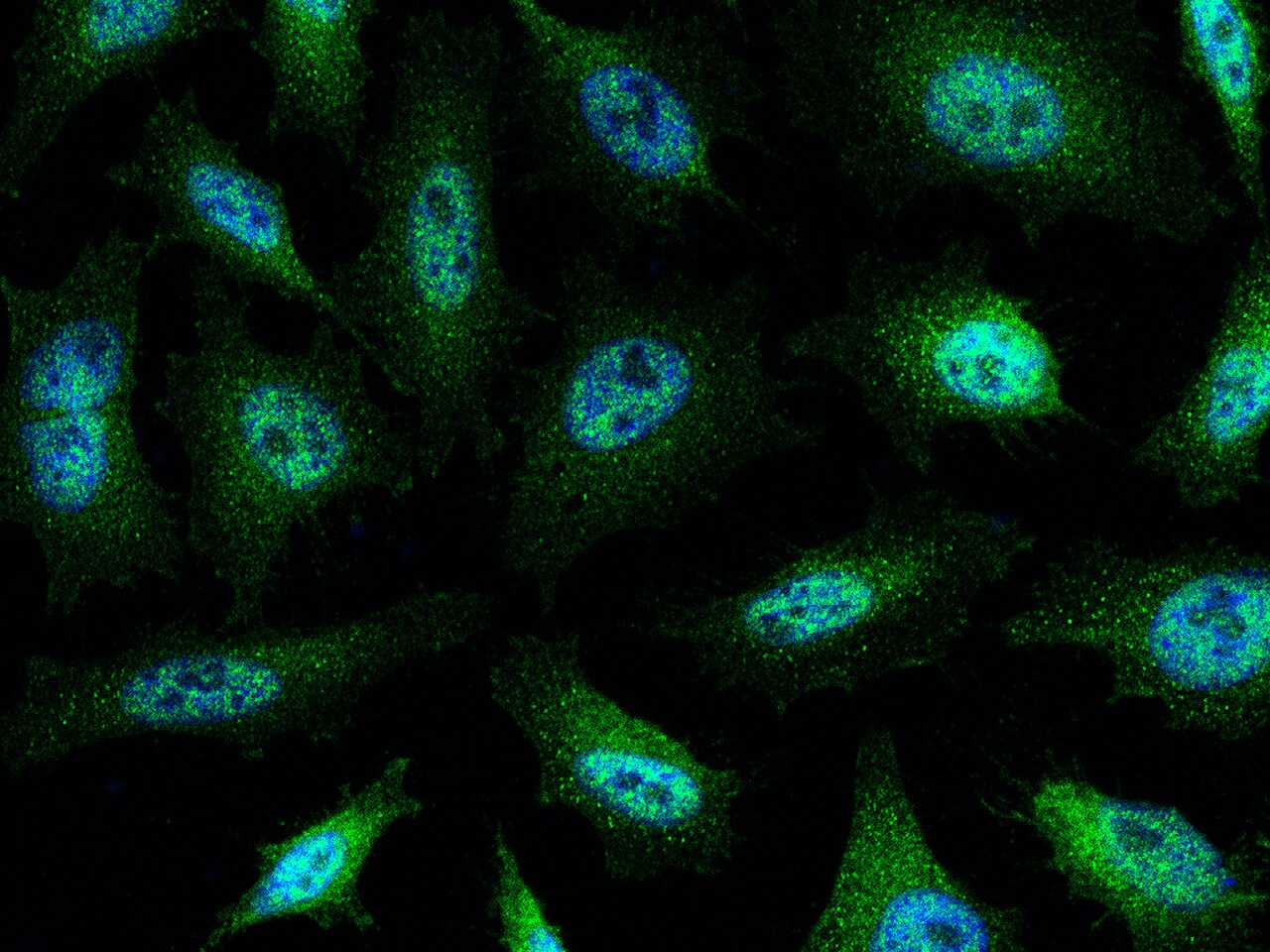 c-Abl Antibody - Azide and BSA Free