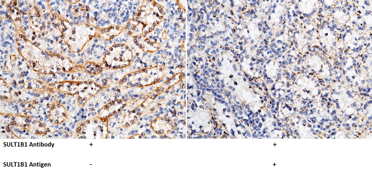 Cytosolic Sulfotransferase 1B1/SULT1B1 Antibody - Azide and BSA Free