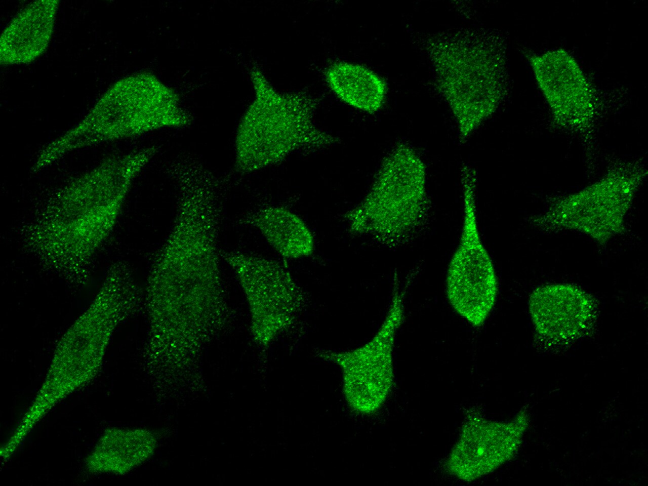 Protein Kinase D2 Antibody - Azide and BSA Free