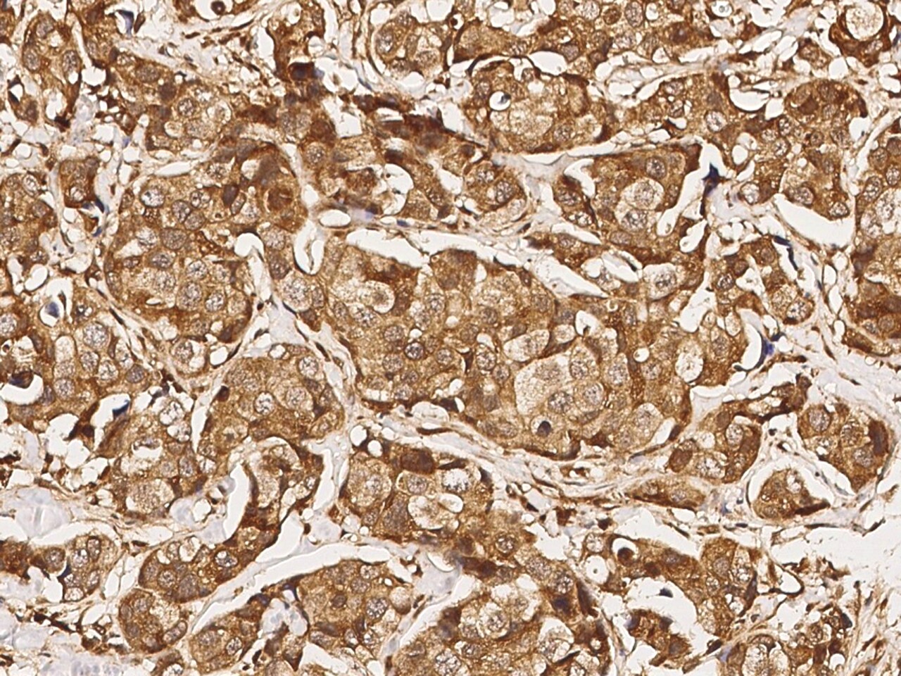 USP46 Antibody - Azide and BSA Free