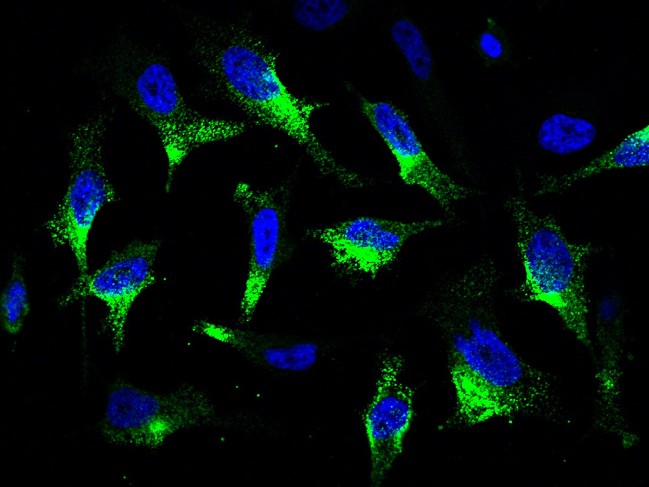 CaMKV Antibody - Azide and BSA Free