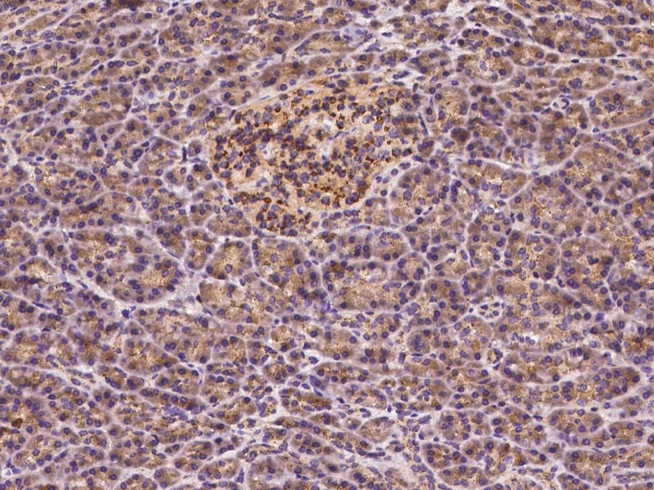 beta-1,3-Glucuronyltransferase 3/B3GAT3 Antibody - Azide and BSA Free