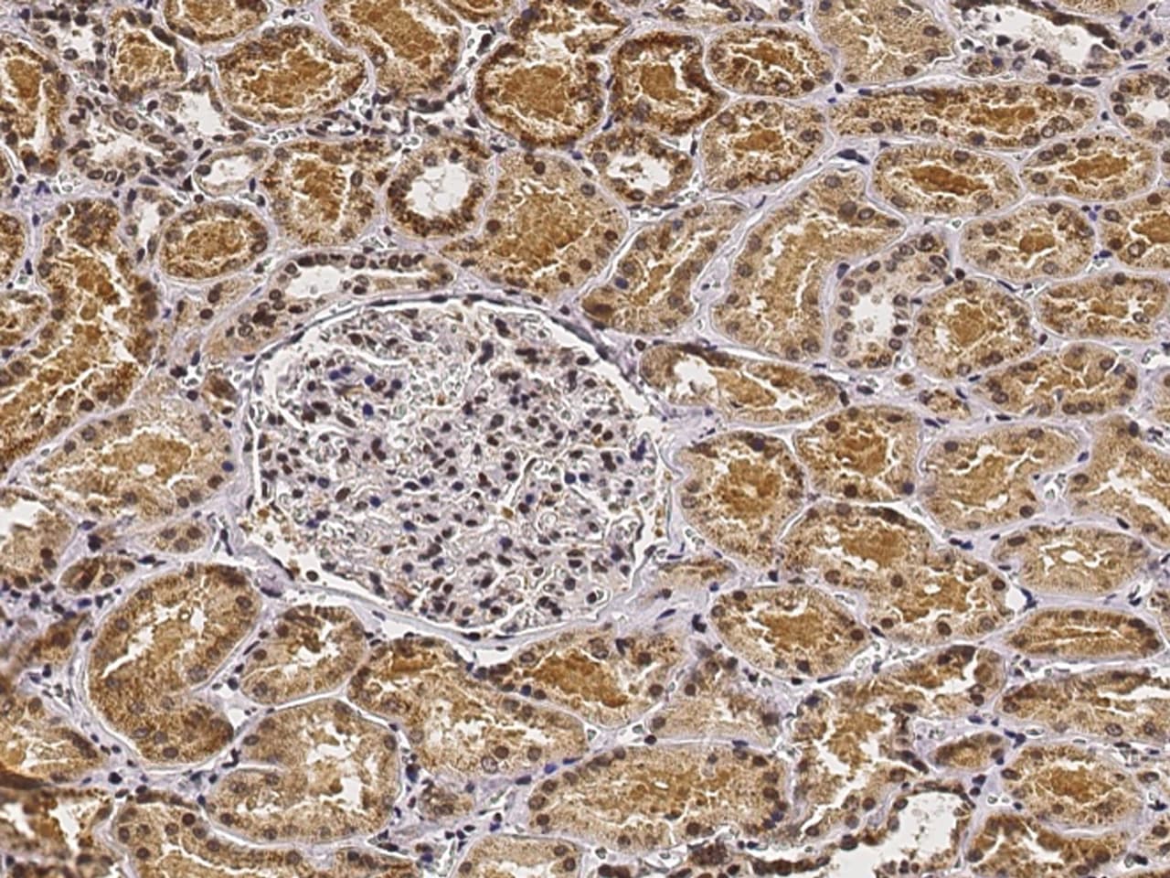 PHYH Antibody - Azide and BSA Free