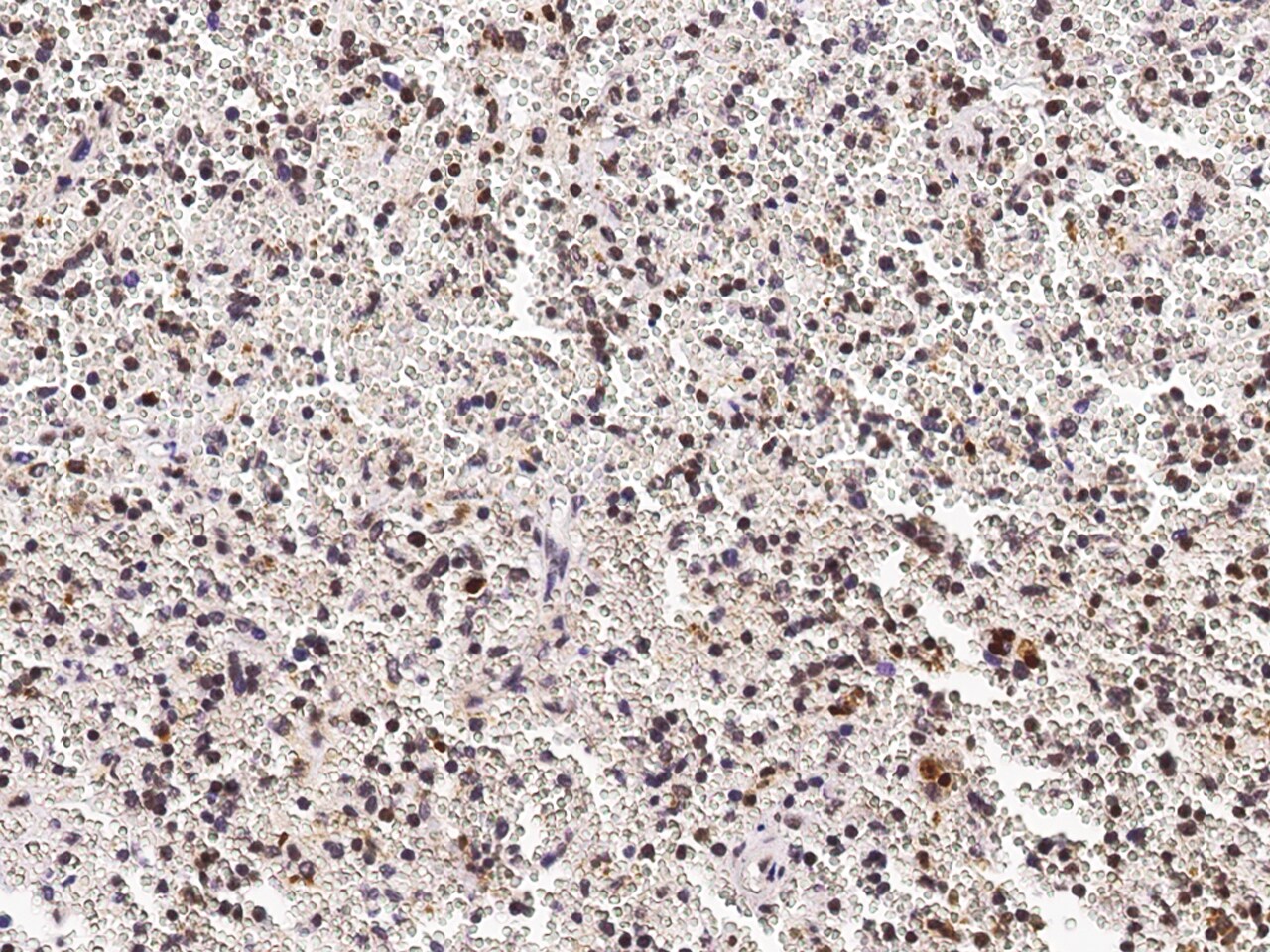 PHYH Antibody - Azide and BSA Free