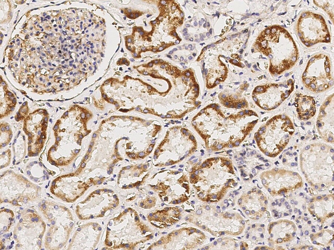 CRELD1 Antibody - Azide and BSA Free