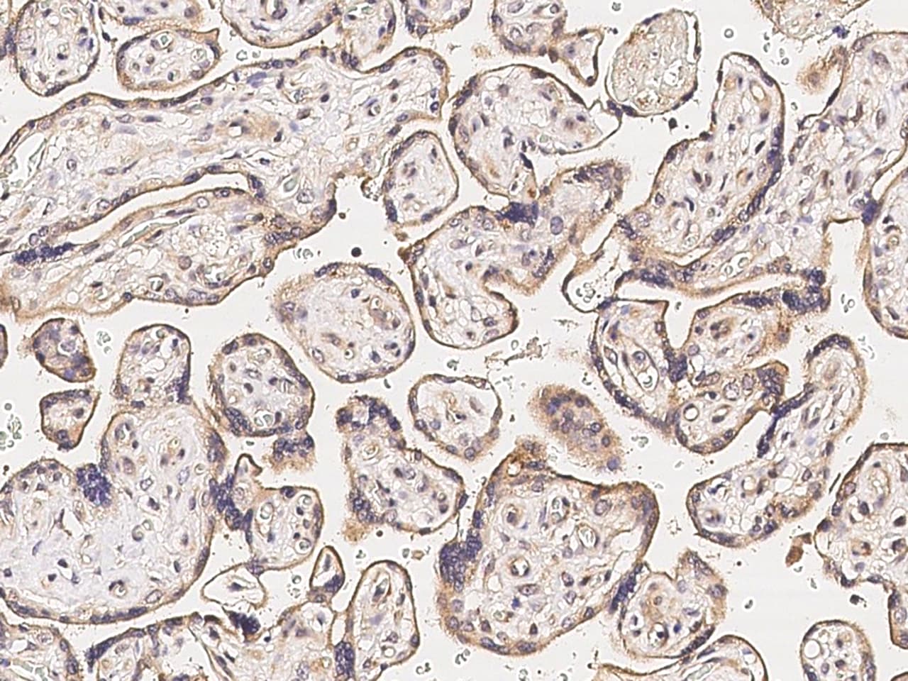 MMP26 Antibody - Azide and BSA Free