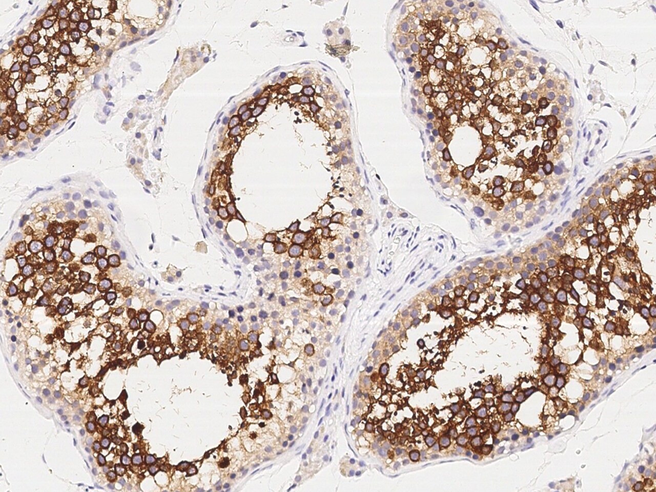 ART3 Antibody - Azide and BSA Free