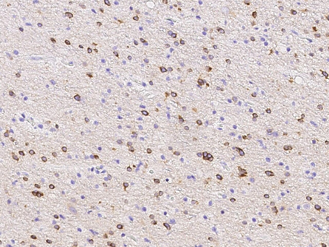 PDE1C Antibody - Azide and BSA Free