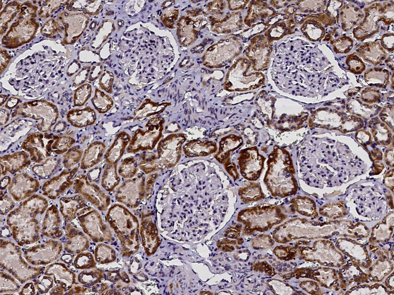 BPHL Antibody - Azide and BSA Free