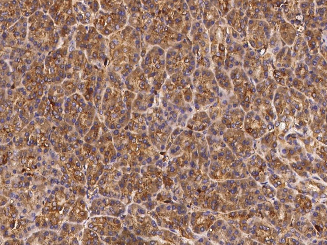 alpha-N-acetylgalactosaminidase/NAGA Antibody - Azide and BSA Free