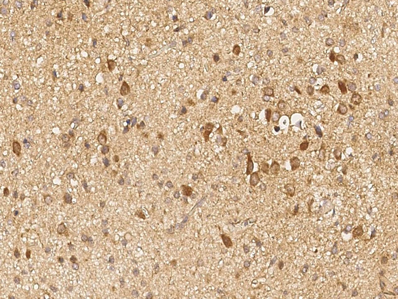 GALNT2 Antibody - Azide and BSA Free