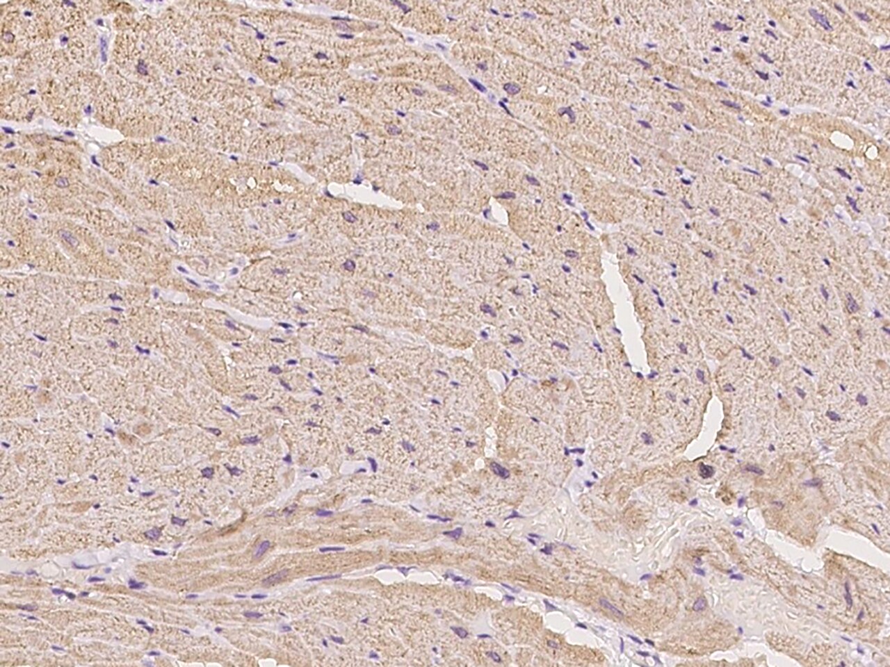 Calsequestrin 1 Antibody - Azide and BSA Free
