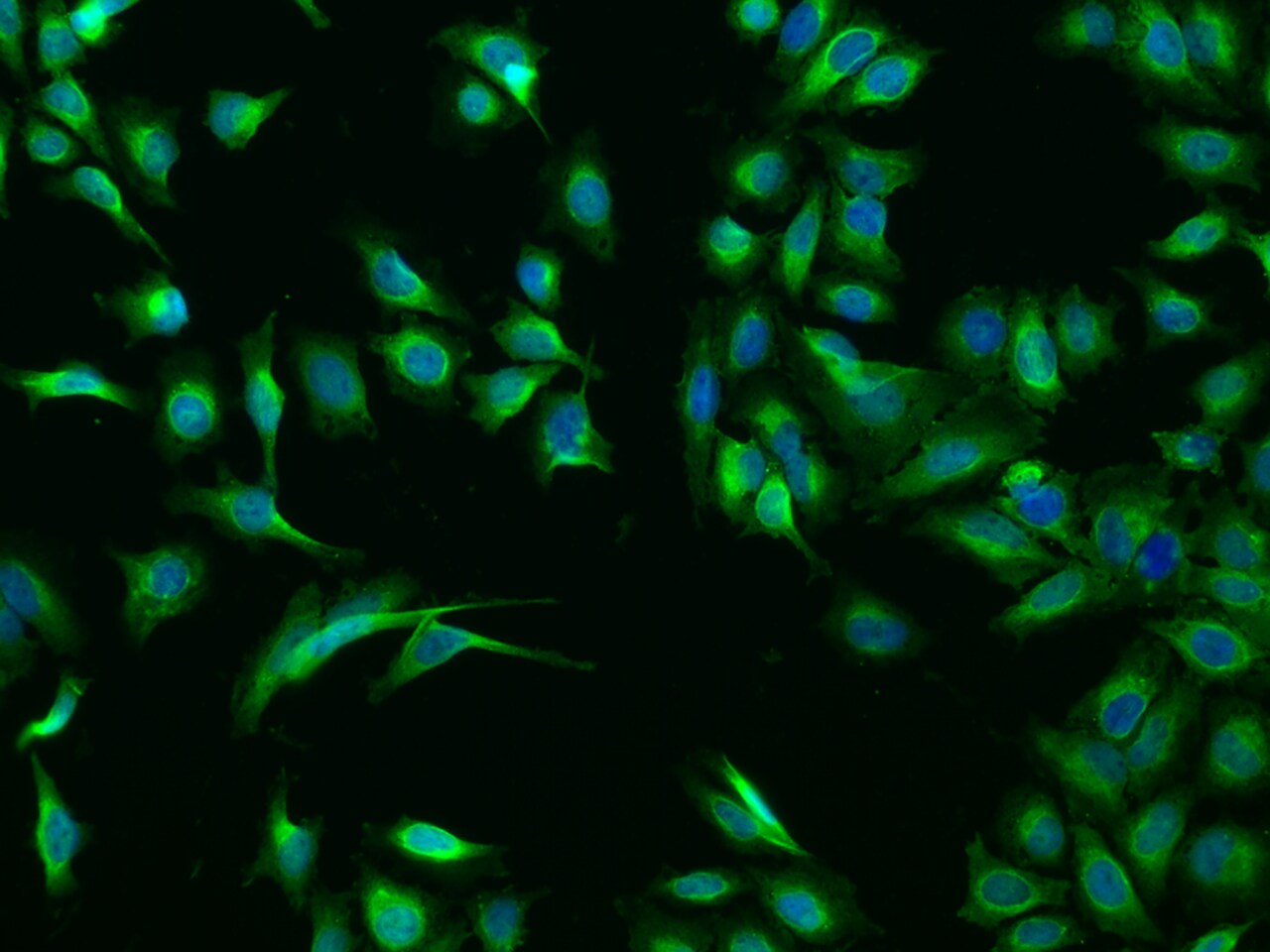 Calsequestrin 1 Antibody - Azide and BSA Free