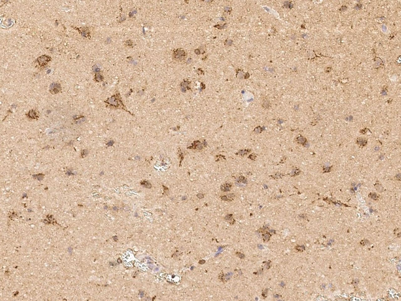 Scn2b Antibody - Azide and BSA Free