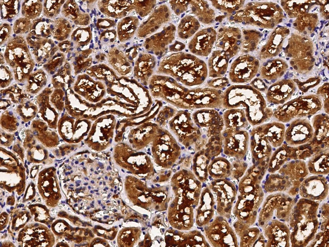ABHD14B Antibody - Azide and BSA Free