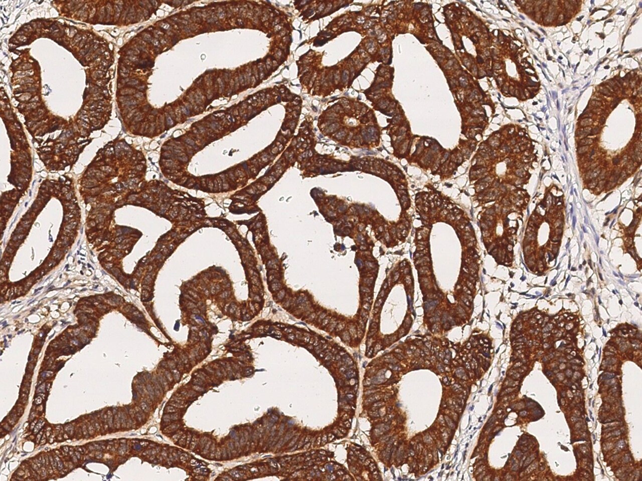 EIF5 Antibody - Azide and BSA Free