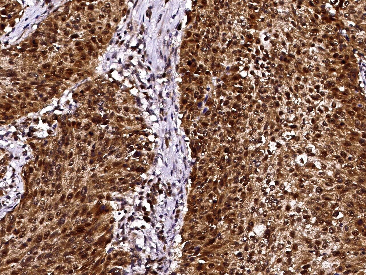 LSM1 Antibody - Azide and BSA Free