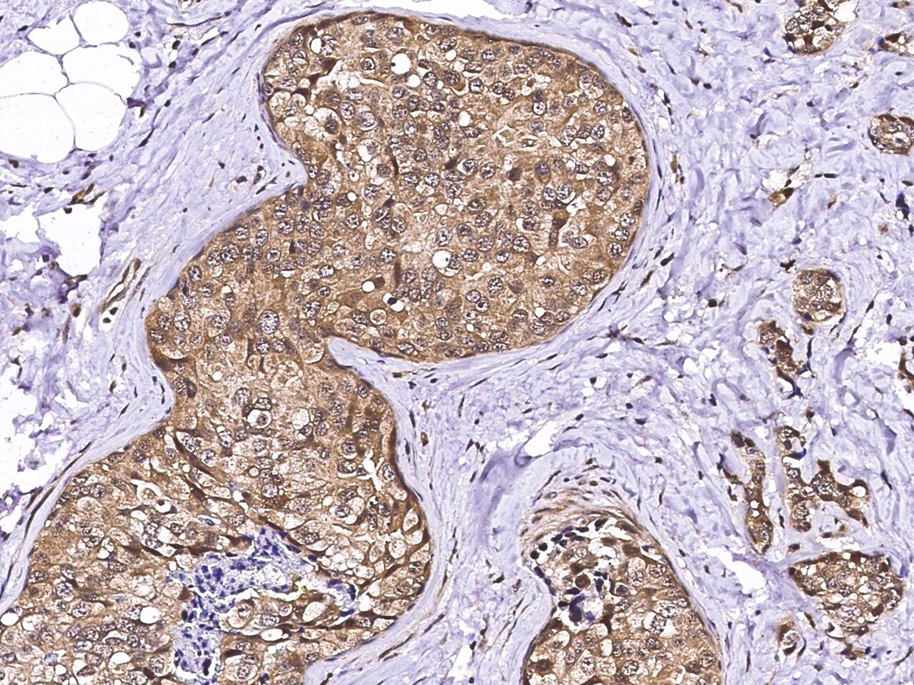 LSM1 Antibody - Azide and BSA Free