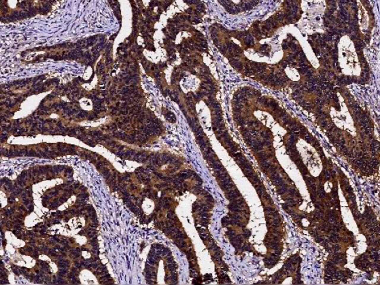 PDRG1 Antibody - Azide and BSA Free