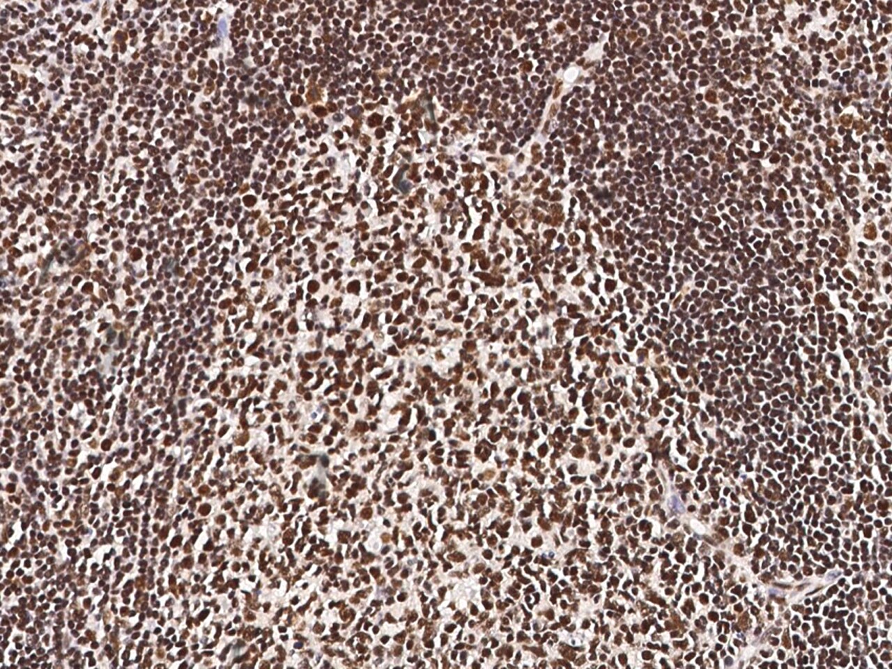 PFDN4 Antibody - Azide and BSA Free