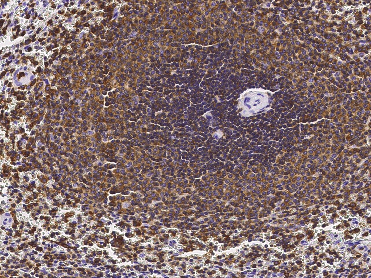 LSP1 Antibody - Azide and BSA Free