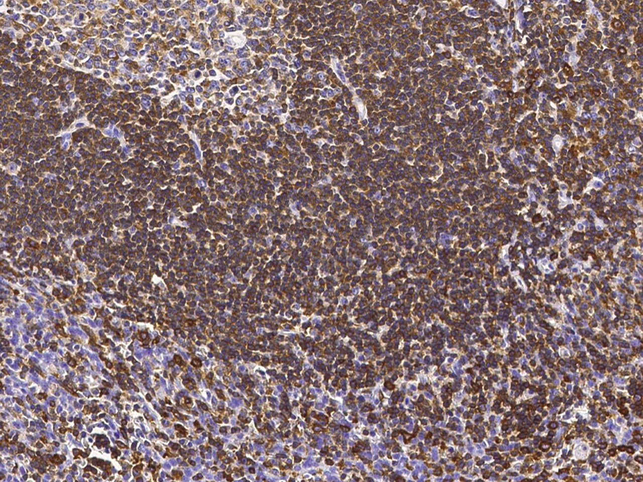 LSP1 Antibody - Azide and BSA Free