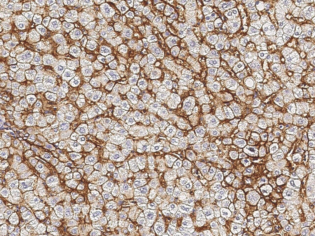 Sodium Potassium ATPase Beta 1 Antibody - Azide and BSA Free
