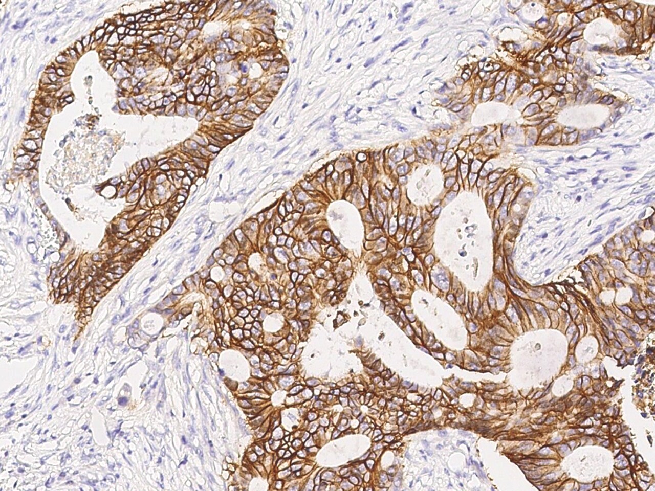 Sodium Potassium ATPase Beta 1 Antibody - Azide and BSA Free