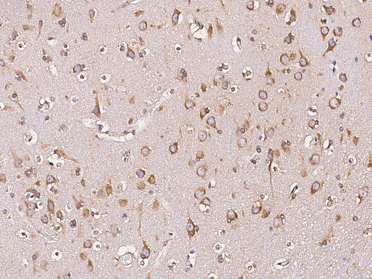 DARS Antibody - Azide and BSA Free