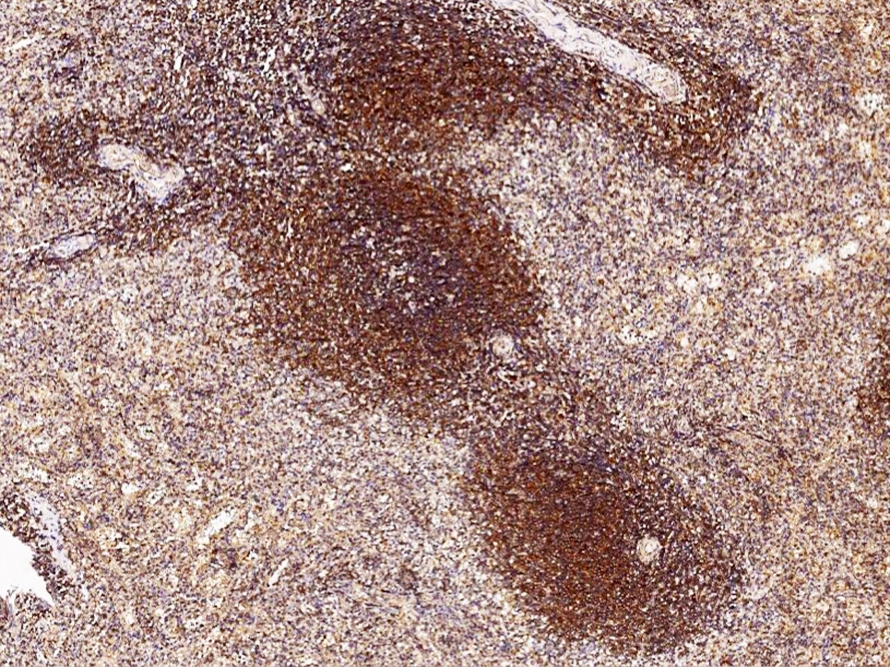 NAA10 Antibody - Azide and BSA Free