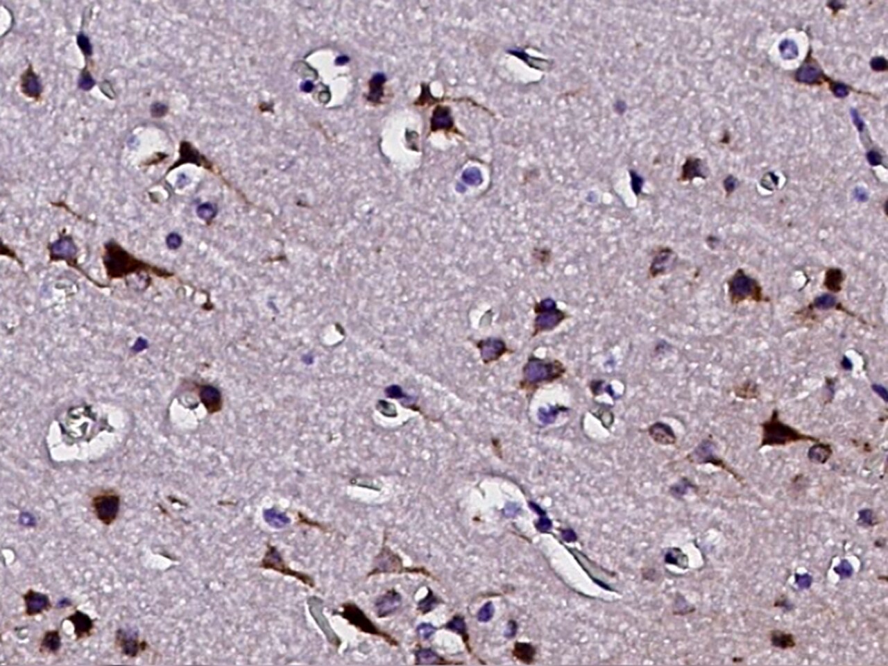 PTS Antibody - Azide and BSA Free