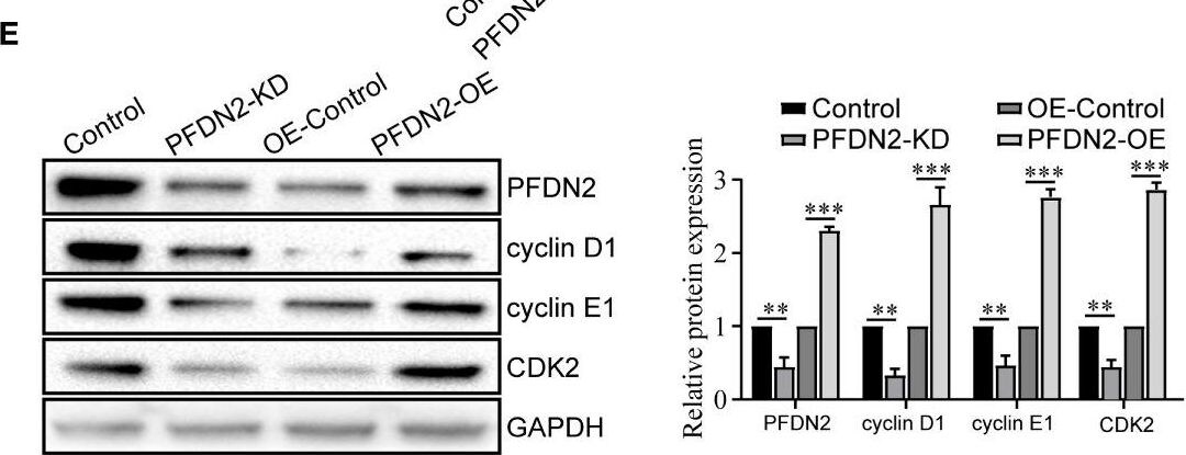 PFDN2 Antibody - Azide and BSA Free