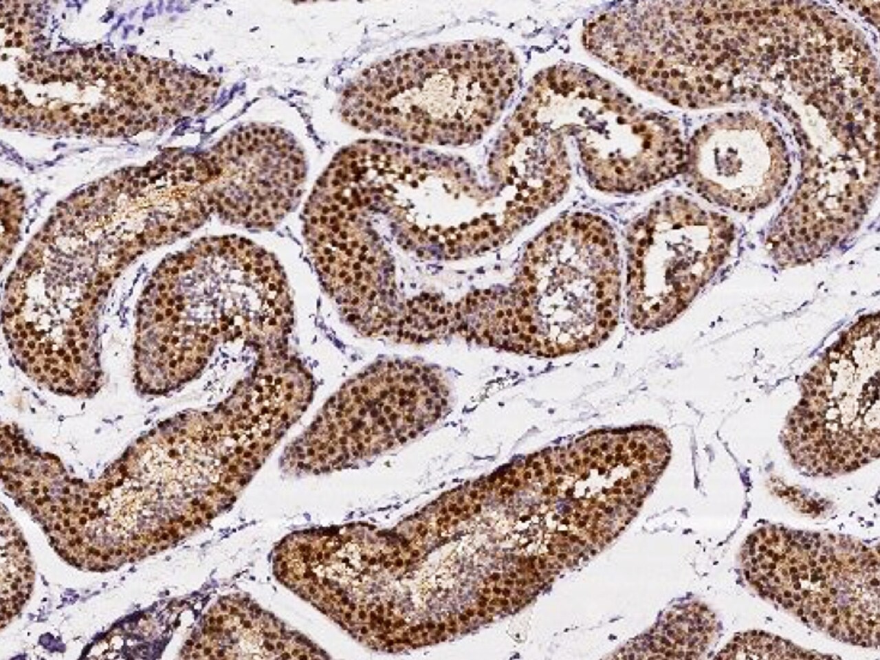 ASF1b Antibody - Azide and BSA Free