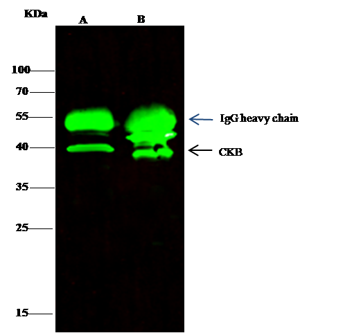 Creatine Kinase BB Antibody - Azide and BSA Free
