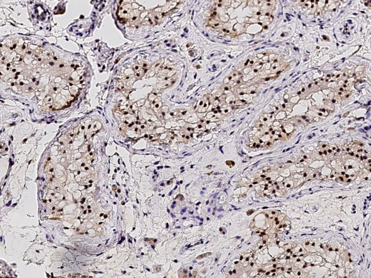 PPIL2 Antibody - Azide and BSA Free