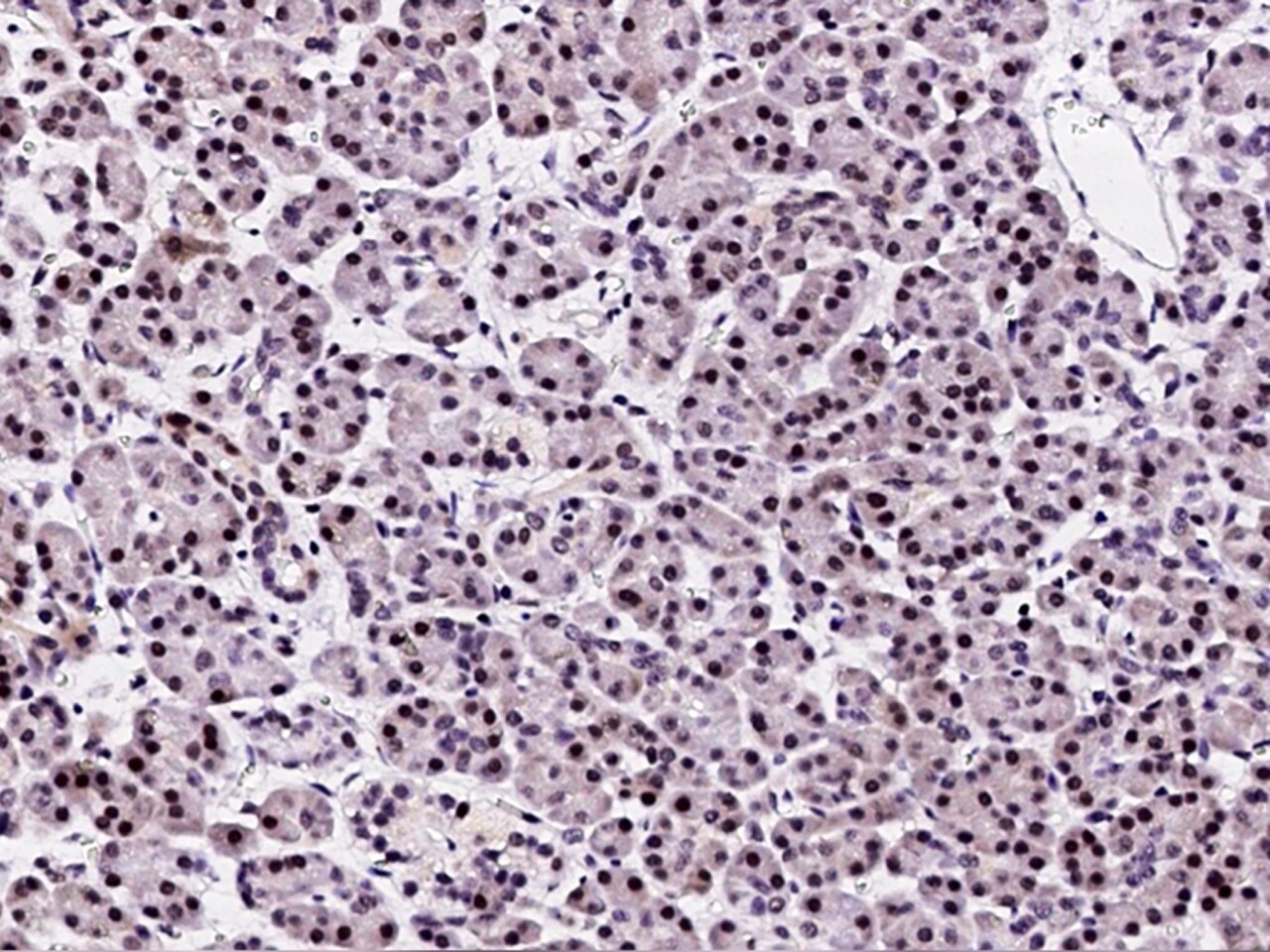 PPIL2 Antibody - Azide and BSA Free