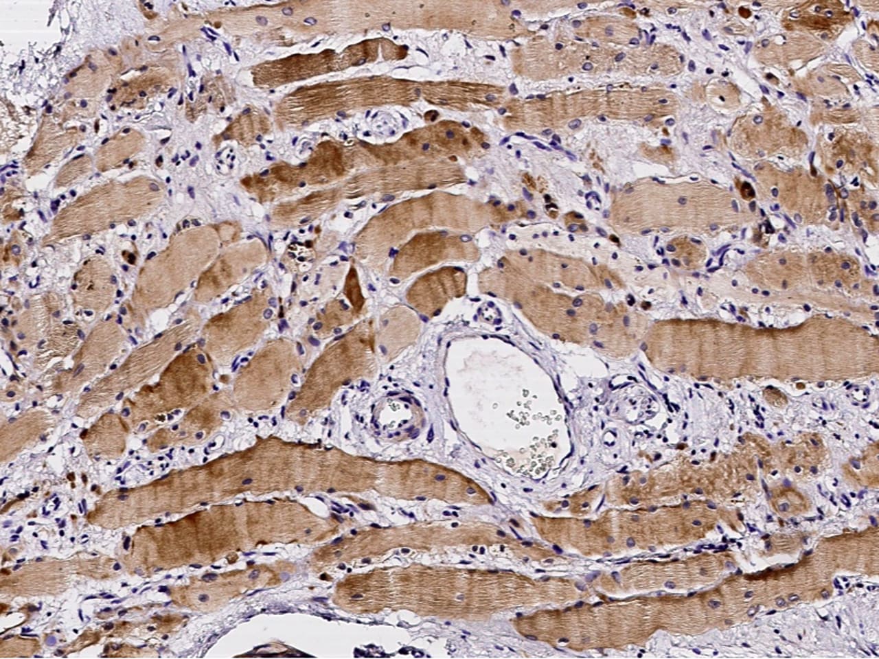 Profilin 2 Antibody - Azide and BSA Free