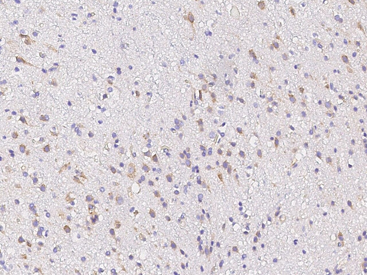 CPLX3 Antibody - Azide and BSA Free