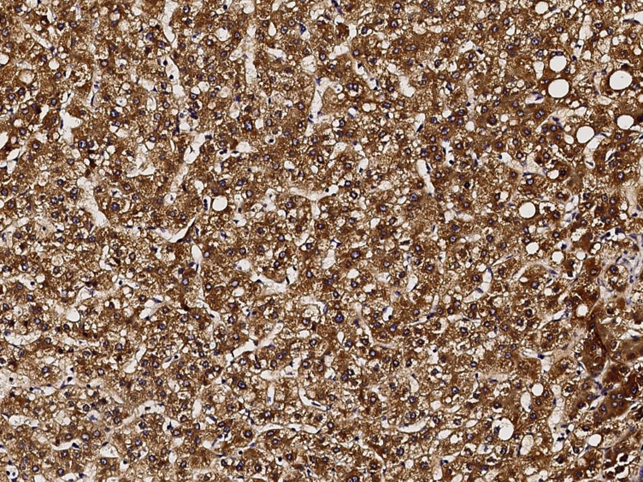 GCSH Antibody - Azide and BSA Free