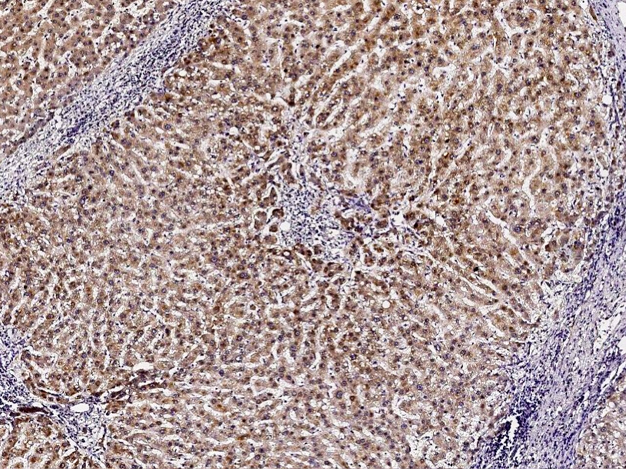 PMVK/phosphomevalonate kinase Antibody - Azide and BSA Free