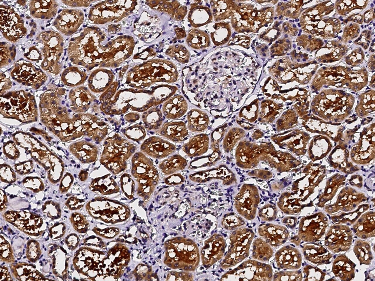 PMVK/phosphomevalonate kinase Antibody - Azide and BSA Free