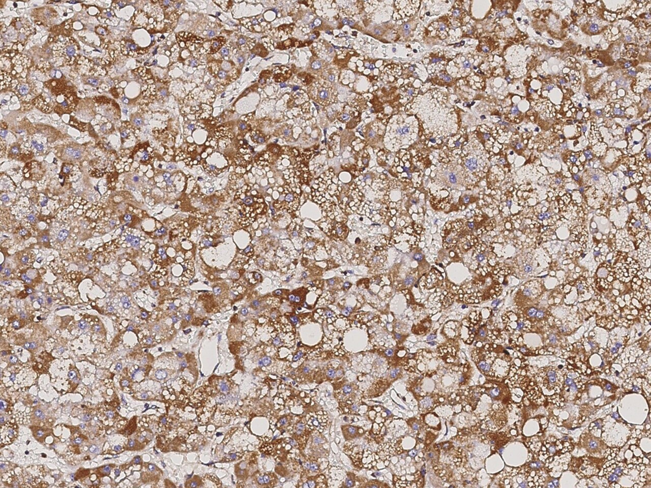 ATP5D Antibody - Azide and BSA Free