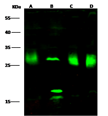 PMM2/Phosphomannomutase 2 Antibody - Azide and BSA Free