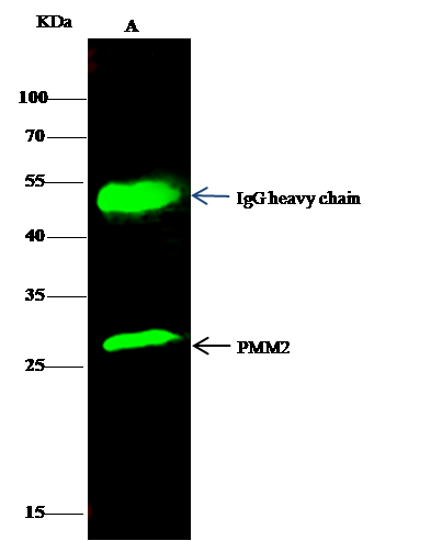 PMM2/Phosphomannomutase 2 Antibody - Azide and BSA Free