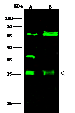 ETHE1 Antibody - Azide and BSA Free