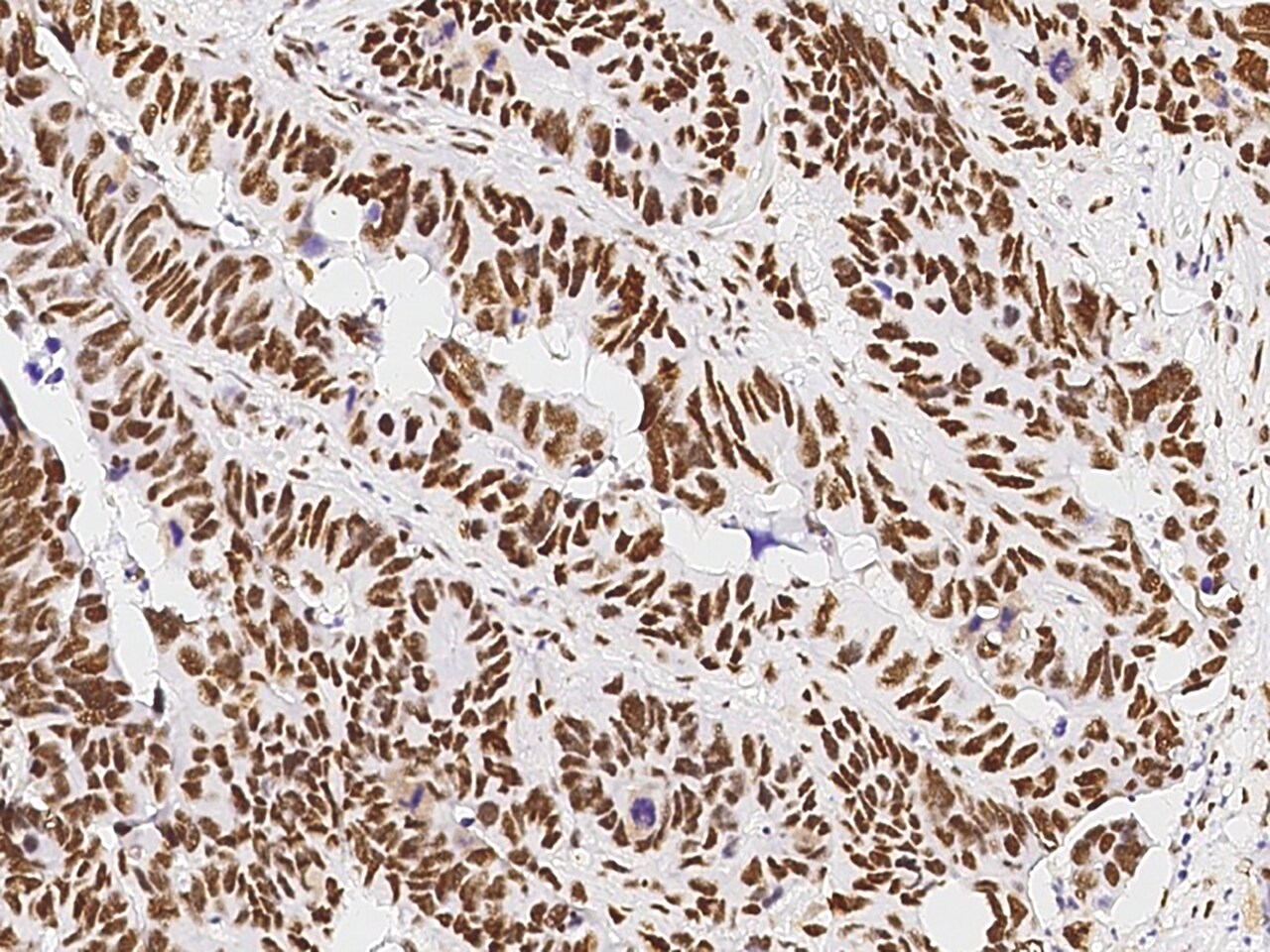 PA28 Activator gamma Subunit/PSME3 Antibody - Azide and BSA Free