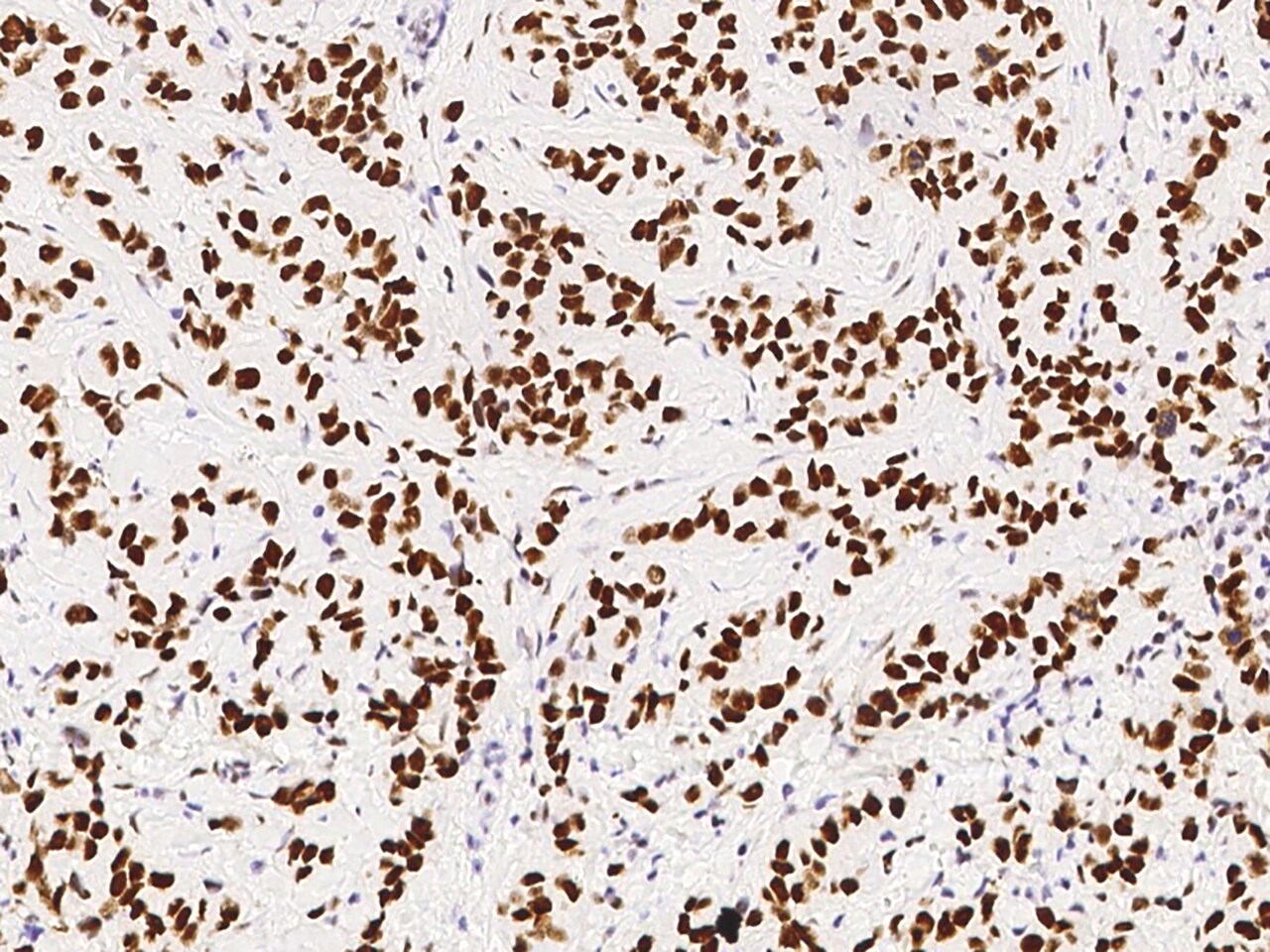 PA28 Activator gamma Subunit/PSME3 Antibody - Azide and BSA Free