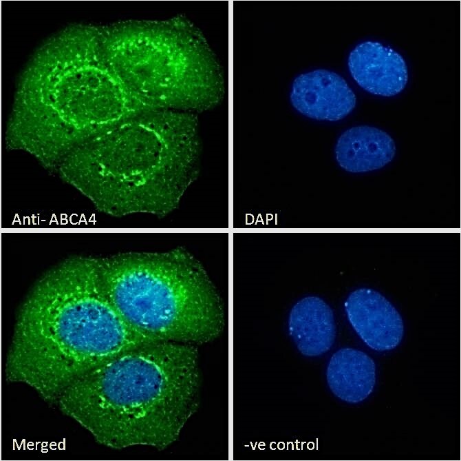 ABCA4 Antibody