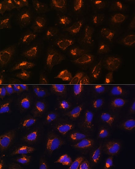 MEK2 Antibody - Azide and BSA Free
