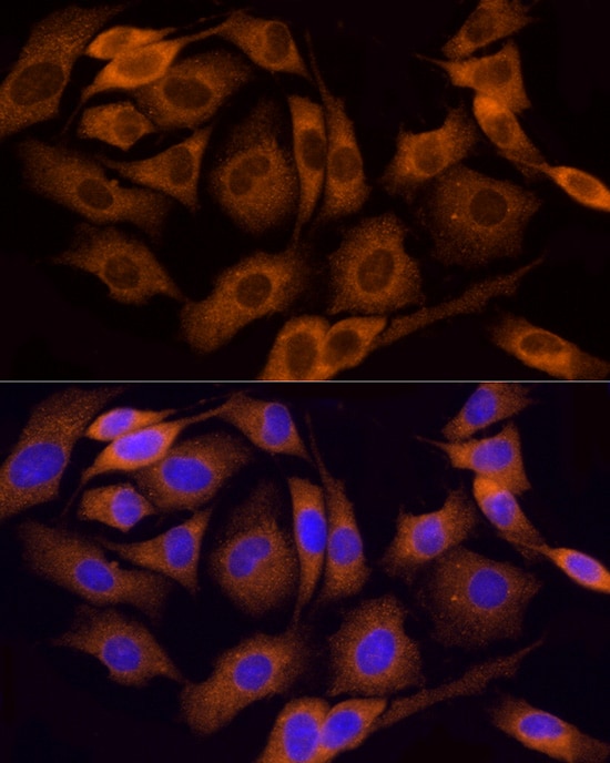 Tumstatin/COL4A3 Antibody - Azide and BSA Free